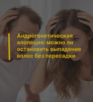 Андрогенетическая алопеция: можно ли остановить выпадение волос без пересадки