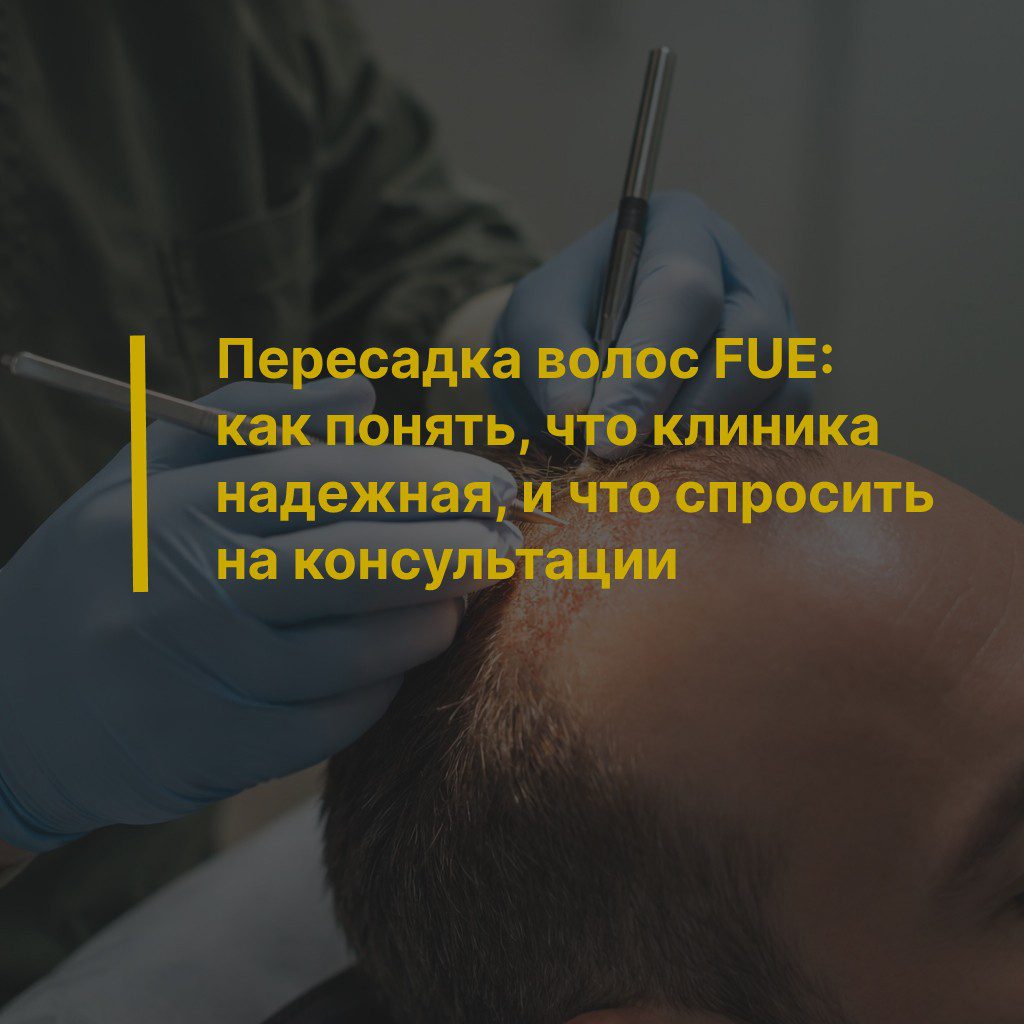 Пересадка волос FUE: как понять, что клиника надежная, и что спросить на консультации