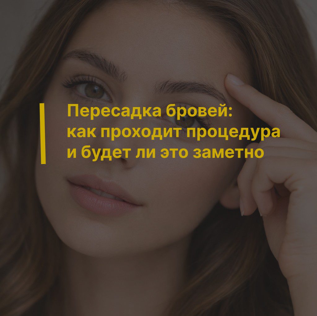 Пересадка бровей: как проходит процедура и будет ли это заметно