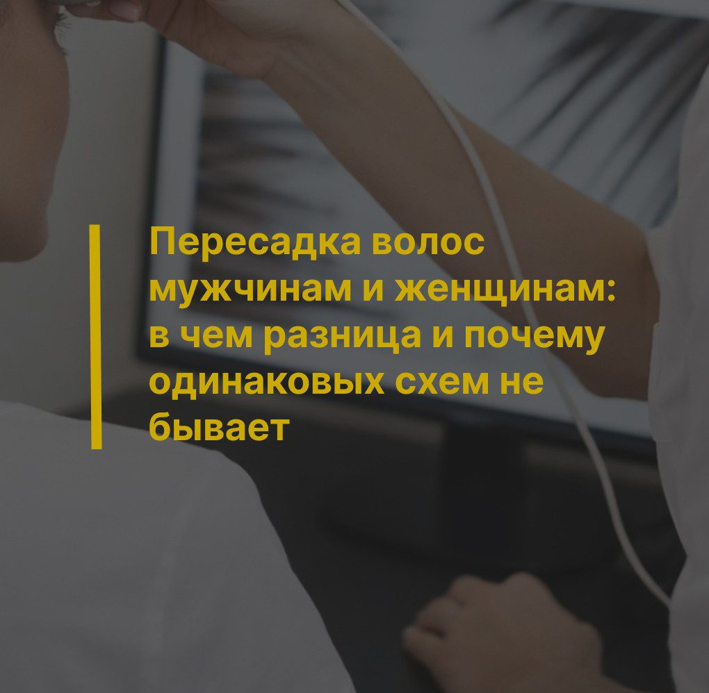 Пересадка волос мужчинам и женщинам: в чем разница и почему одинаковых схем не бывает