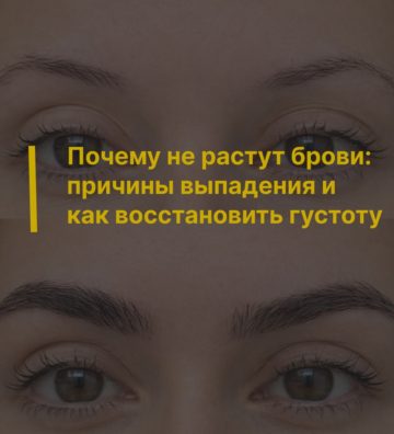 Почему не растут брови: причины выпадения и как восстановить густоту