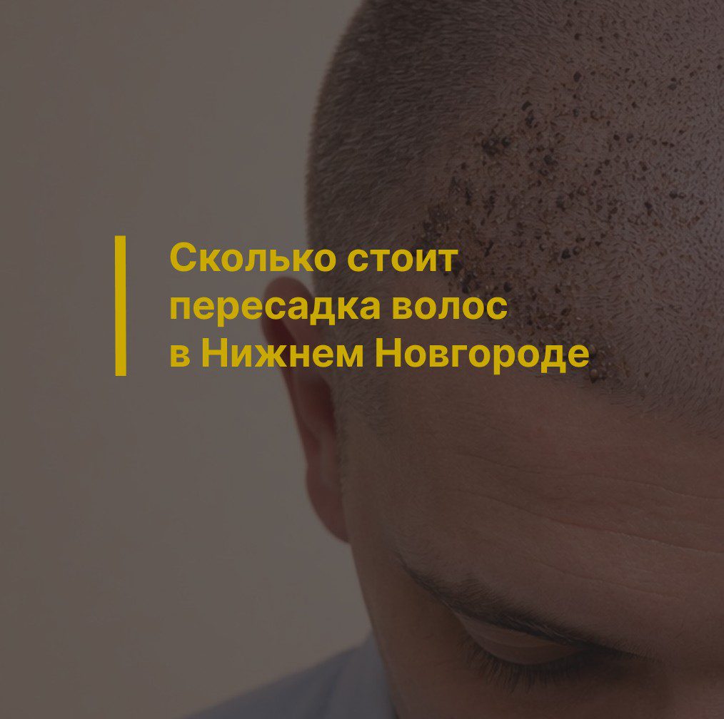 Сколько стоит пересадка волос в Нижнем Новгороде