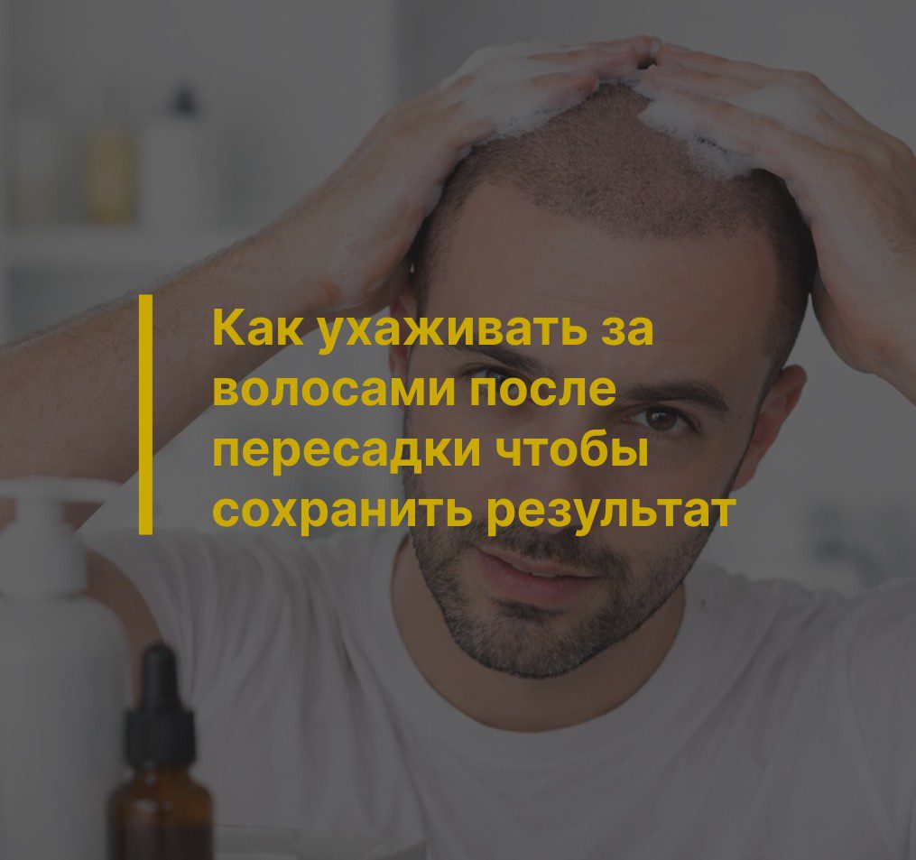 Как ухаживать за волосами после пересадки чтобы сохранить результат